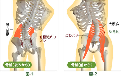 歪み改善の一例です