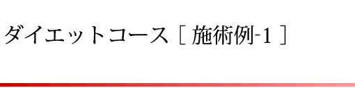 ダイエットコース[施術例-1]