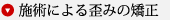 ▼● 施術による歪みの矯正