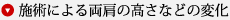 ▼● 施術による両肩の高さなどの変化