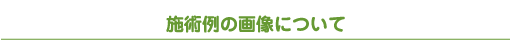 施術例の画像について