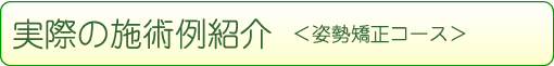 実際の施術例紹介＜姿勢矯正コース＞