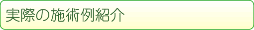 実際の施術例紹介