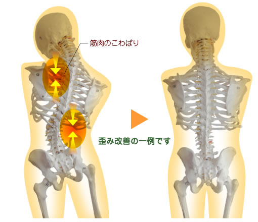 歪み改善の一例です